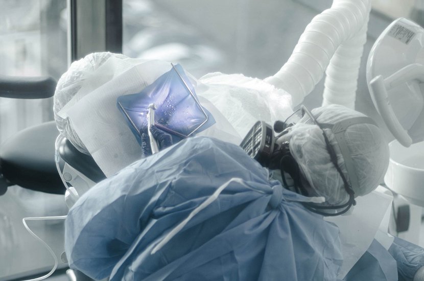 Amalgam Dolgu Nedir?
